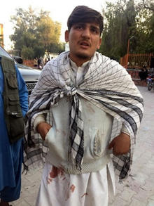 JVCの活動地の青年。マラック・ジャンダールさんも彼も負傷者を助けていらっしゃったそうで、服に鮮血が付いています