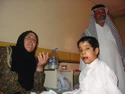 口から出血する子ども　サダム小児病院改め、中央小児教育病院で