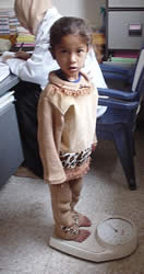 中等度の栄養失調だったが、体重は増加し改善傾向