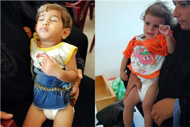 重度の栄養失調と診断されたアマニちゃん（左）とダハちゃん。早く元気になってね